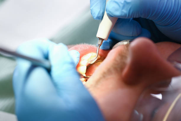 Best Emergency Cosmetic Dentistry in South Burlington, VT