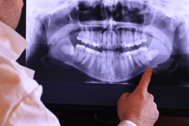 Best Emergency Dental Services for Seniors in South Burlington, VT