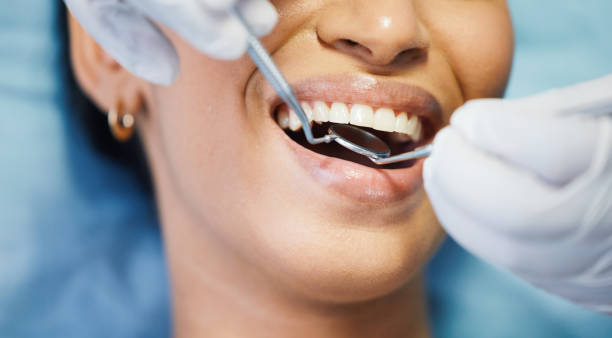 Best Mobile Emergency Dentist in South Burlington, VT